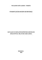 artigo implante.pdf