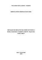 artigo implante.pdf