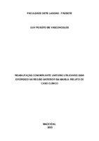 artigo implante-GUY.pdf